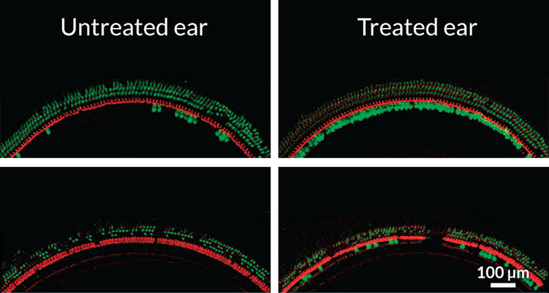 Illustration for article titled Promising Study Shows the Power of Gene Therapy to Treat Deafness